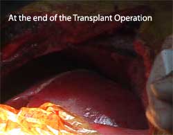 http://laparoscopicsurgeon.net.au/images/end_operation.jpg